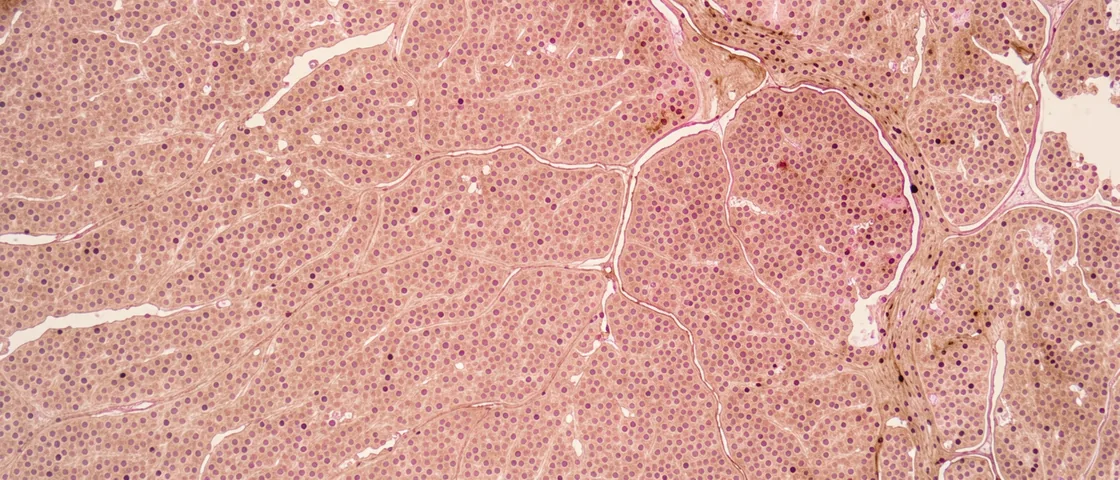 Illustrative micrograph of anterior pituitary tissue with endocrine-cell clusters beside fine capillaries.
